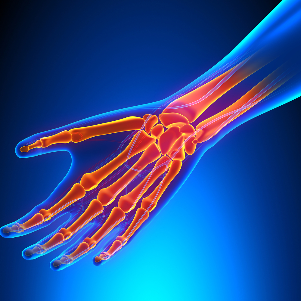 Karpaltunnelsyndrom – Hand-Diagnostik in der Orthopädie Mannheim